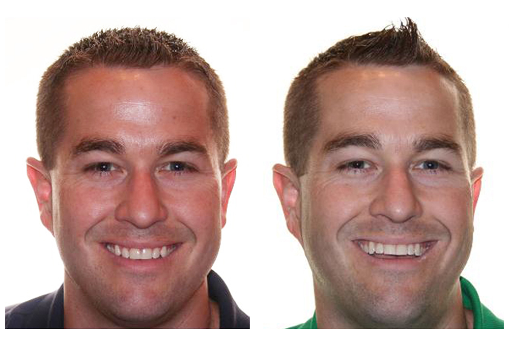 The Dental Loft at Perry Hall