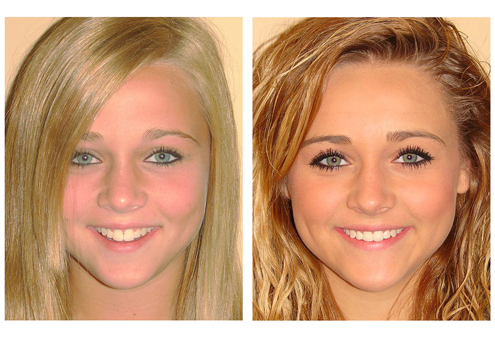 The Dental Loft at Perry Hall